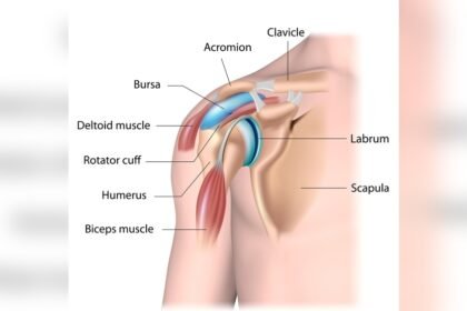 Can Massage Help Bursitis