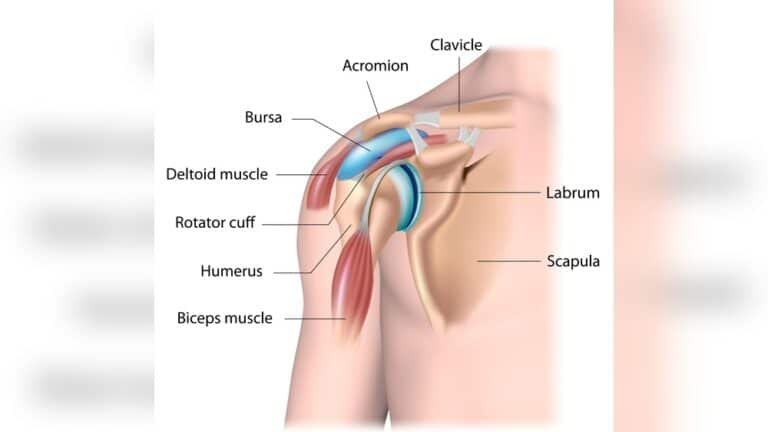 Can Massage Help Bursitis