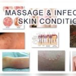 Can You Get Std from Massage Table