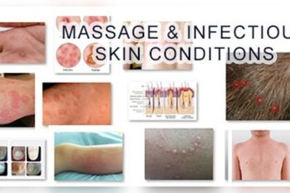 Can You Get Std from Massage Table