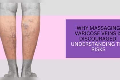 Can You Massage Varicose Veins