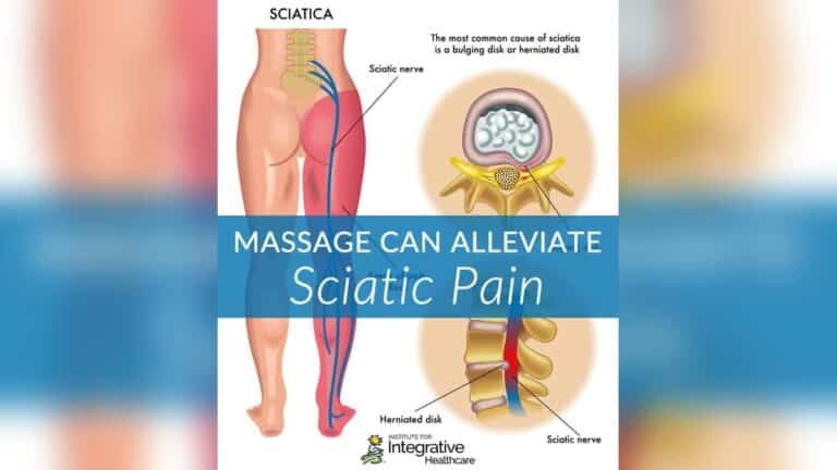 Does Massage Help Sciatica Pain