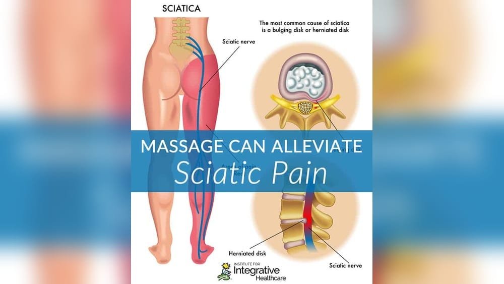 Does Massage Help Sciatica Pain