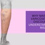 Does Massage Help Varicose Veins