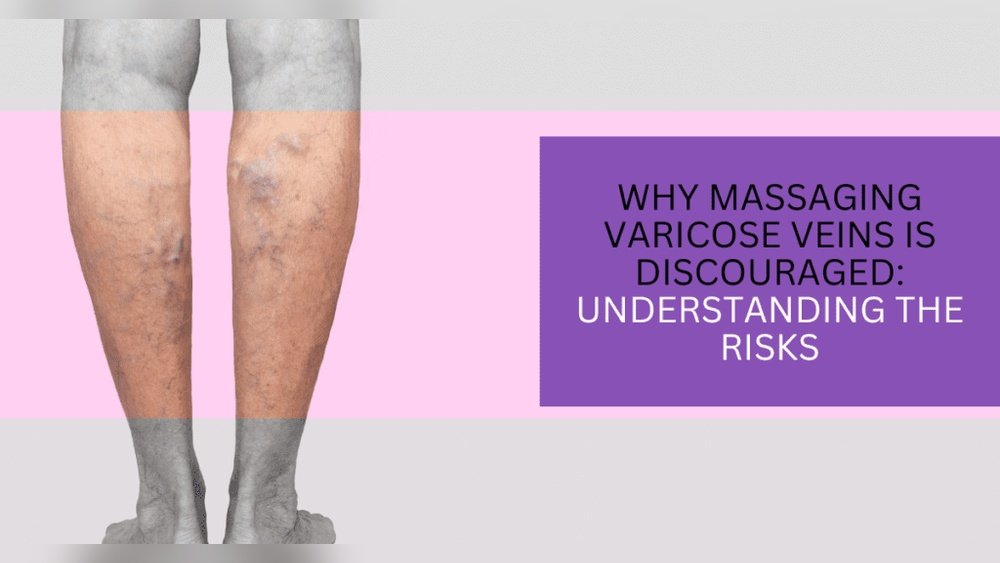 Does Massage Help Varicose Veins