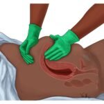 How Often Should I Massage Fundus