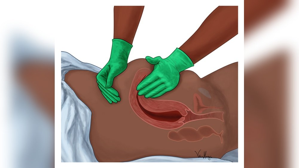 How Often Should I Massage Fundus