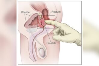 How to Do Prostate Massage