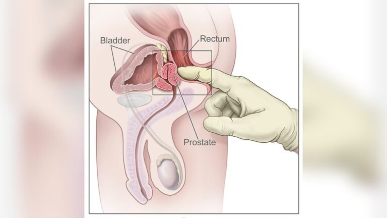 How to Do Prostate Massage