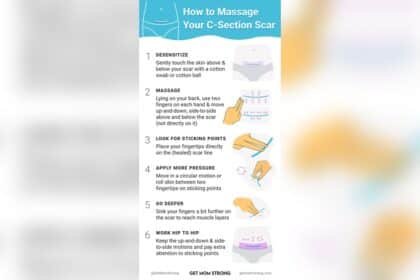 How to Massage C Section Scar