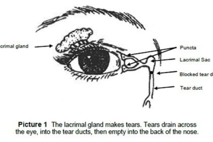 How to Massage Tear Duct