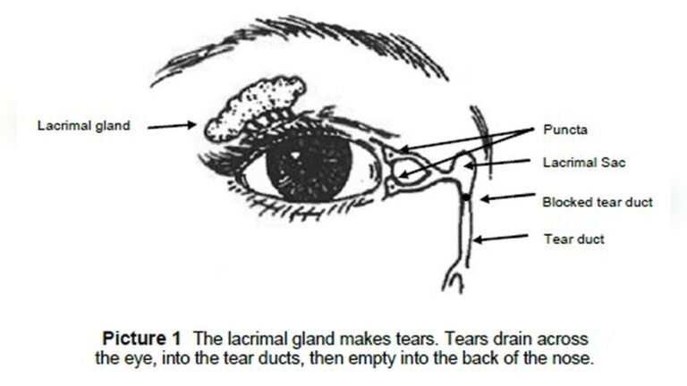 How to Massage Tear Duct