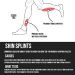 Should You Massage Shin Splints