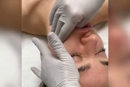 What is Buccal Massage