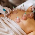 What is Cupping Massage