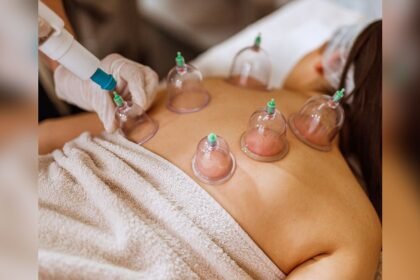 What is Cupping Massage