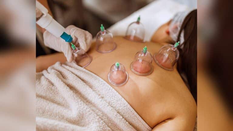 What is Cupping Massage