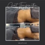 What to Avoid After Lymphatic Drainage Massage