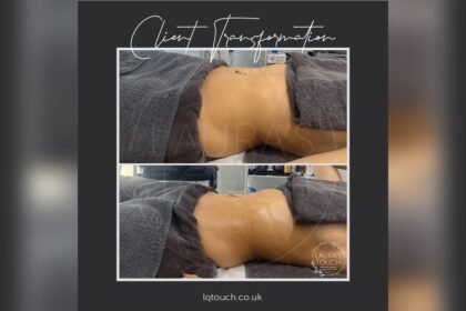 What to Avoid After Lymphatic Drainage Massage