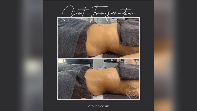 What to Avoid After Lymphatic Drainage Massage