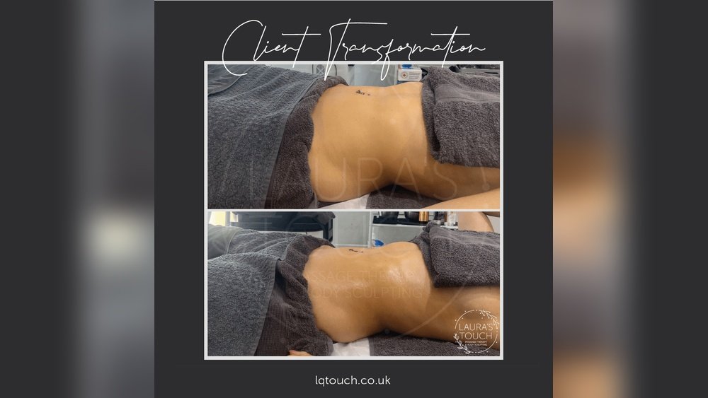 What to Avoid After Lymphatic Drainage Massage