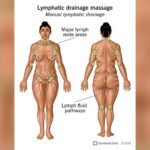 Where to Get Lymphatic Drainage Massage