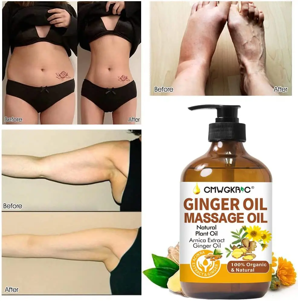 Ginger Oil,Ginger Massage Oil for Lymphatic Drainage,Natural Body Oil for Skin,Arnica Oil,Sore Muslce Massage Oil,Spa Ginger Oil-Warming and Relaxing for Mothers Day GiftsFathers Day Gift