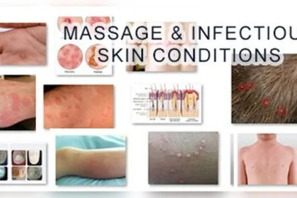 Can You Get Std from Massage Table