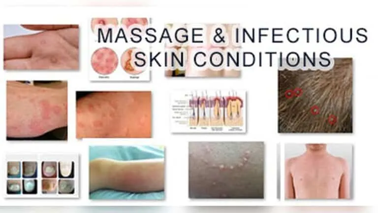 Can You Get Std from Massage Table