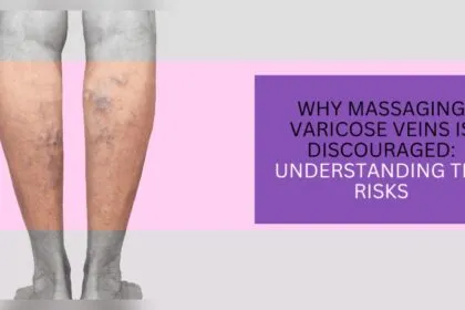 Can You Massage Varicose Veins