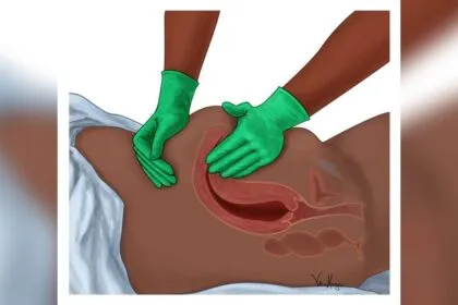 How Often Should I Massage Fundus