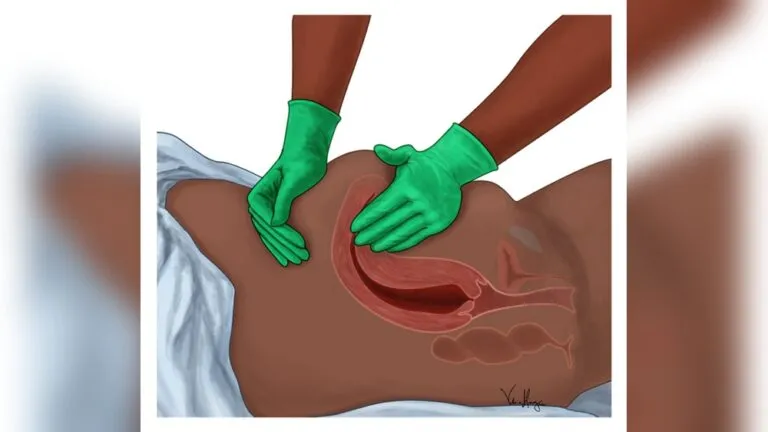 How Often Should I Massage Fundus