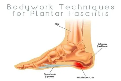 How to Massage for Plantar Fasciitis