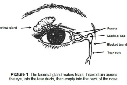 How to Massage Tear Duct