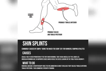 Should You Massage Shin Splints