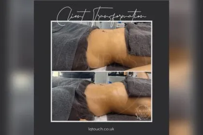 What to Avoid After Lymphatic Drainage Massage