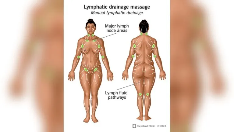 Where to Get Lymphatic Drainage Massage